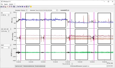 CVRanalysis: a free software for analyzing cardiac, vascular and respiratory interactions